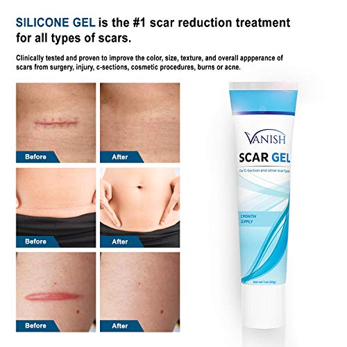 Vanish Silicone Scar Gel ExtraStrength Silicone Scar Removal Cream