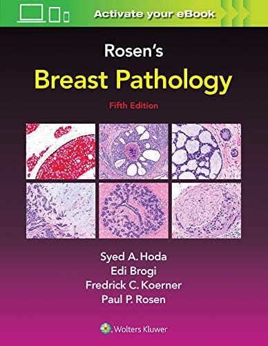 Diagnostic Histopathology of Tumors, 2 Volume Set: Expert Consult