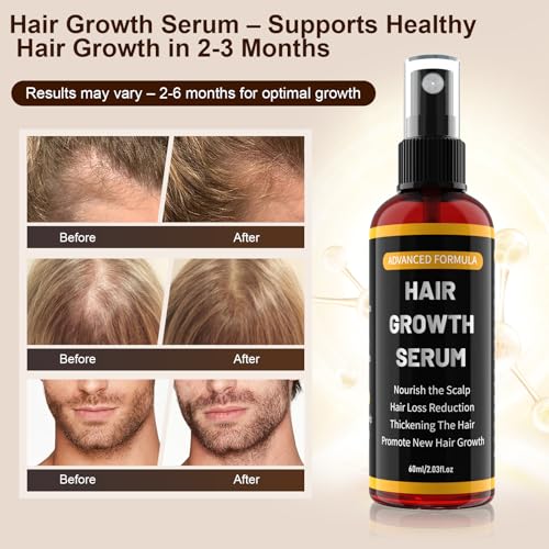 Hair Growth Serum with Rosemary Oil, Biotin, Niacinamide & Castor Oil – Hair Loss Spray for Women & Men, Scalp Serum for Hair Thickening & Strengthening, Beard Care, 60ml