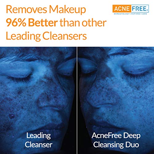 Acne Free Facial Cleansing Brush and Oil-Free Acne Cleanser Acne Treatment Kit with Benzoyl Peroxide 2.5% and Glycolic Acid (1 Brush, 1 Cleanser)