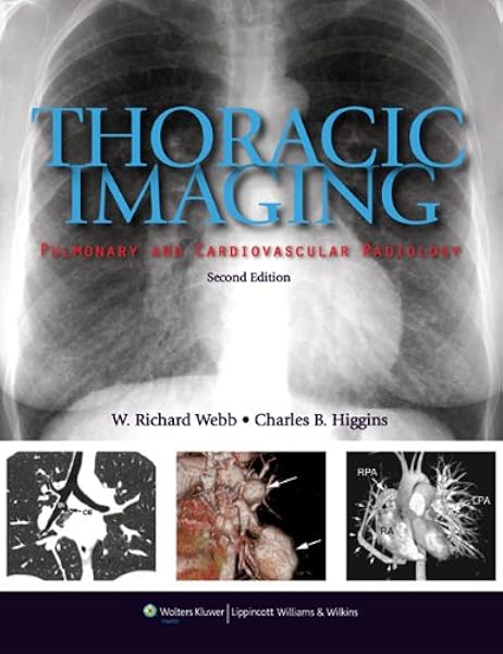 Thoracic Imaging Pulmonary And Cardiovascular Radiology 9781605479767 Medicine Health Science Books Amazon Com