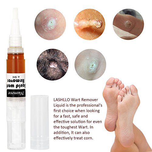 Wart Remover, Plantar Wart Remover, Wart Removal, Corn Remover, Wart Removal Pen with Natural Ingredients, Penetrates and Remove Plantar Warts, Corns, Callus, Stops Wart Regrowth, 5mlX2 - Thumbnail 3