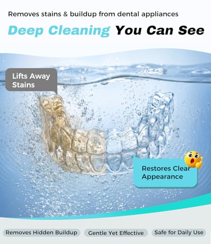 Ultrasonic Retainer Cleaner Machine, 45kHz Deep Gentle Dental Cleaning Pod with 304 Stainless Steel Tank, 4 Cleaning Modes for Aligners, Dentures, Mouth Guards, Night Guards, Toothbrush Heads