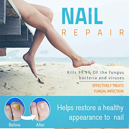 GD Gmgod❤️❤️NailCare Nail Regen Bio-Pen Nail Care Pen Effective Fragile Nail Repair 2pcs Blue
