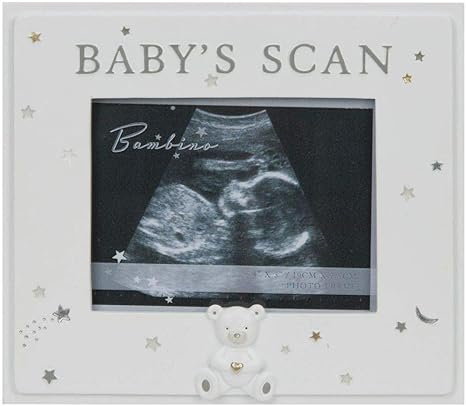 Resin Baby Scan Photo Frame 