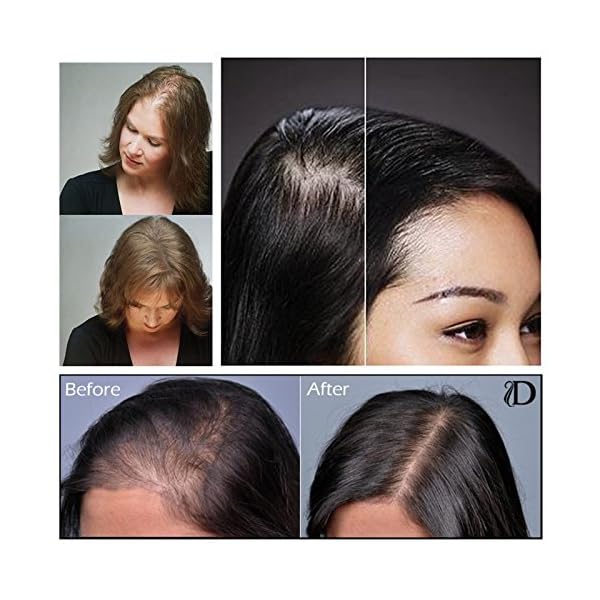 Volumon-Professional-Hair-Building-Fibres-Hair-Loss-Concealer-COTTON-28g-Get-Upto-30-Uses-CHOOSE-FROM-8-HAIR-SHADES-COLOURS-Dark-Brown Volumon Professional Hair Building Fibres- Hair Loss Concealer- COTTON- 28g- Get Upto 30 Uses- CHOOSE FROM 8 HAIR SHADES…