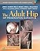 The Adult Hip: Hip Preservation Surgery