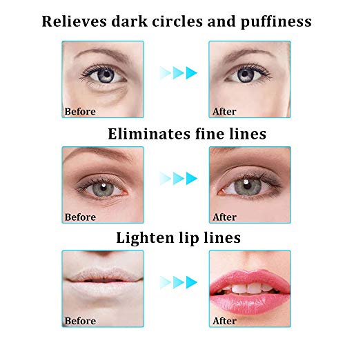 SEED Eye Massager, Heated Sonic Vibration Eye Massager, Rechargeable 42℃ Facial Massager Roller Wand Pen For Anti-aging Wrinkle,Relieving Dark Circles,Fatigue and Puffiness