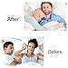 Stop Snoring Solution - Anti Snore Devices Sleep Aid Tongue Sleeve for Natural Sleep with BPA & Toxin Free Silicone Includes Protective Case
