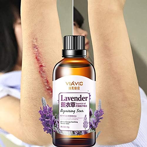 Chicoco Repairing Essential OilNatural Essential Oils to Repair Scars and Fade marksLavender Repairing Essential Oil Massage Aroma Aromatherapy Stress Reliever
