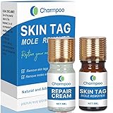 Skin Tag Removal - All Natural Mole and Skin Tag