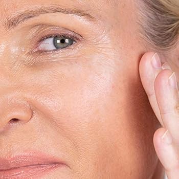 dr dennis gross retinol cream