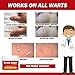 DR. WART - Extreme Wart Remover - Works on All Warts! - Plantar Warts, Common Warts, Flat Warts, Warts on Hands, Body and Feet - No More Warts with Dr. Wart!