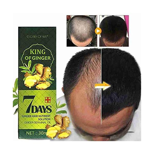 Hair Growth Serum, Hair Care Product, Hair Serum, Fast Hair Growth, Hair Growth & Hair Thickening,Stop Hair Loss, Grow…