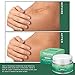 Tetyana naturals Scar Removal Cream Advanced Treatment for Old & New Scars from Cuts Stretch Marks C-Sections & Surgeries With Natural Herbal Extracts Formula （hypoallergenic）