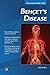 Behcet’s Disease (MyModernHealth FAQs)