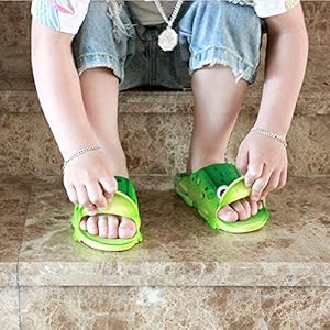 frog sandals shoes