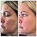 Rodan and Fields Reverse Regimen for Brown Spots, Dullness, and Sun Damage, 4 Count