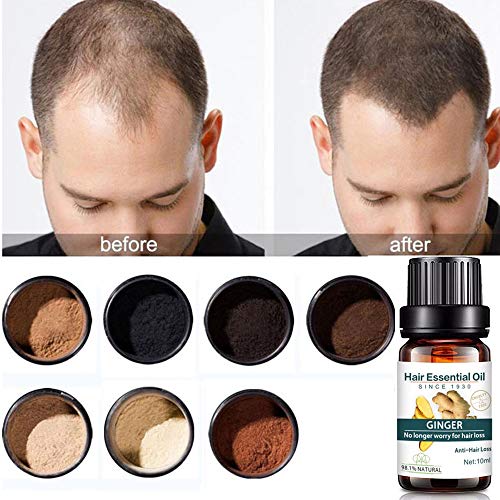 Kasien Hair Growth Liquid, Natural Ginger Hair Growth Essence liquid Fast Hair Growth Natural Hair Loss Treatment (2 Pcs)
