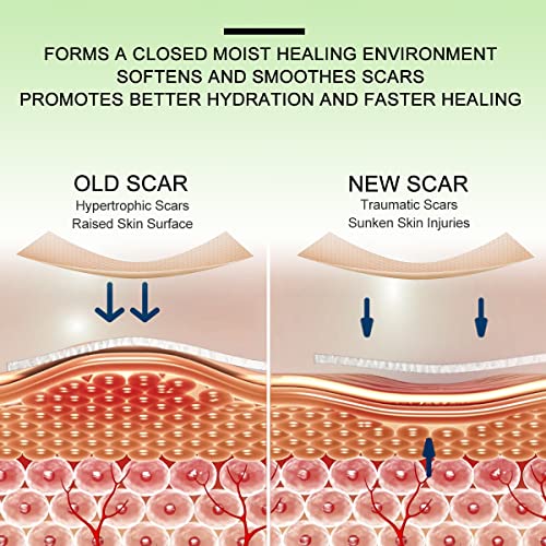 ZODENIS Scar Away Silicone Scar Sheets, Scar Tape(1.8” x 157”Inch- 4M), Scar Strips, Reusable, Professional Scar Remover for C-Section, Surgery, Keloid, Tummy Tuck, Scar Patch, Scar Pads.