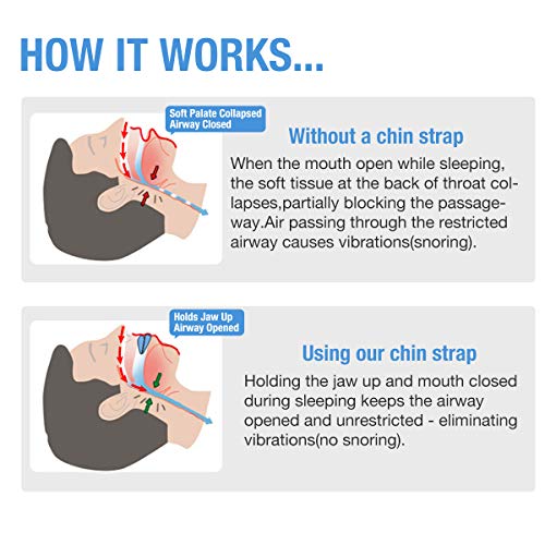 image for Anti Snoring Chin Strap, Snoring Stopper Solution, Anti Snoring Device
