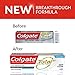 Colgate Total Toothpaste, Deep Clean, 5.1 Ounce, Pack of 2