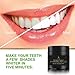 Teeth Whitening Charcoal Powder Natural - Activated Charcoal Teeth Whitening Kit – Teeth Whitener (30g)