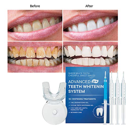 Teeth Whitening Kit, For Sensitive Teeth, With Led Light, Comfortable