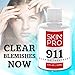 SkinPro Rapid Repair Acne Treatment | The Fastest Working (Medical Grade) Formula | Highly Concentrated Salicylic Acid Solution | Remove Acne and Blackheads Fast