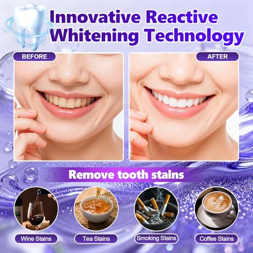 14 pares Tiras blanqueadoras moradas,Tiras blanqueadoras dientes,Blanqueamiento dental rápido,Dientes blanqueador dental,Para dientes para el café vino, tabaco y otras manchas