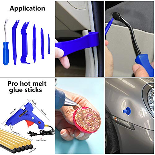 YOOHE 59 PCS Auto Body Paintless Dent Repair Tool Kits – Gold Dent Lifter Dent Puller Kit with LED Light Line Board for Car Dent Removal and Hail Damage
