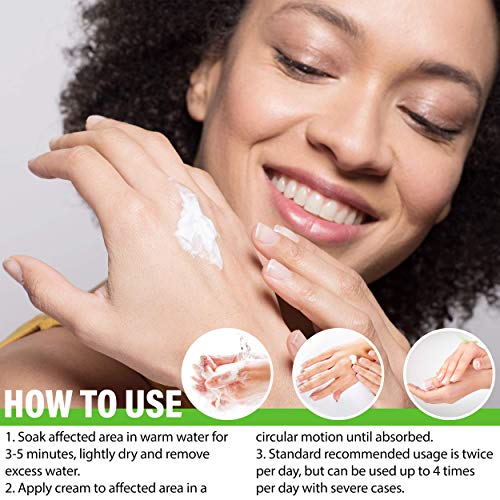 WELLUTION Antifungal Cream Natural Athletes Foot Treatment Supports