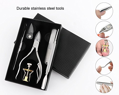 6 Pcs Ingrown Toenail Tools Kit - 6 in 1 Gold Professional Pedicure Toes Treatment Tools with Nail Corrector, Clipper, Cleaner, File for Thick Ingrown Toenails Correction Orthotic Appliance Set