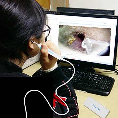 Xiaomax Digital LED Otoscope Ear Camera Scope Earwax Removal Kit Ear