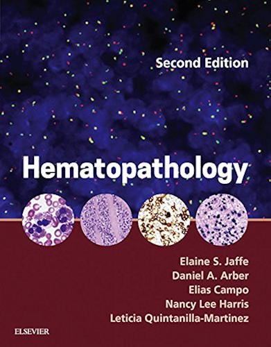 Download Hematopathology E-Book (English Edition) PDF