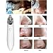 IREALIST Electronic Blackhead Extractor, USB Rechargeable Blackhead Removal Facial Pore Cleaner Acne Remover Tool (White)