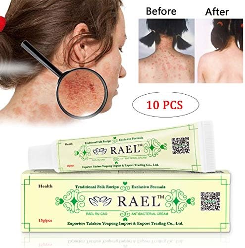 GARYOB Antibacterial Cream Natural Gentle Repair Psoriasis Eczema Dry Itching Herbal cream (10PCS)