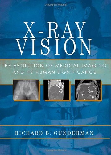 X-Ray Vision The Evolution of Medical Imaging and Its Human Implications (Paperback)