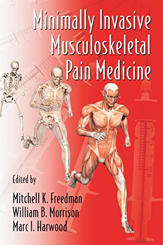 Minimally Invasive Musculoskeletal Pain Medicine (Minimally Invasive Procedures in Orthopaedic Surge by CRC Press