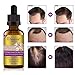 Avashine Natural Hair Growth Serum, Ginger Essential Oil, Hair Growth oil, Anti Hair Loss Essence, Hair Thinning Treatment, Healthy Strong Thick Hair, Treats Baldness Weak Brittle Thinning Hairthumb 1