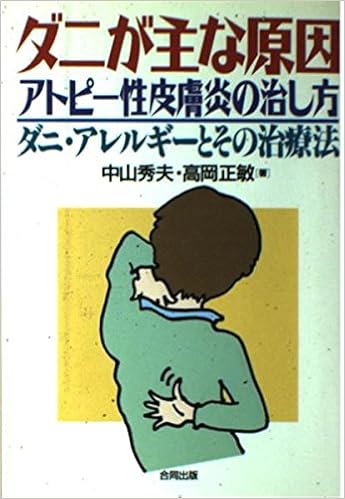 ダニが主な原因 アトピー性皮膚炎の治し方 ダニ アレルギーとその治療法 秀夫 中山 正敏 高岡 本 通販 Amazon