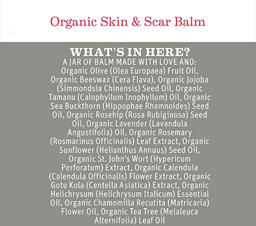 Earth Mama Organic Skin & Scar Balm for C-Section Scars and Stretch Marks, 1-Fluid Ounce - //medicalbooks.filipinodoctors.org