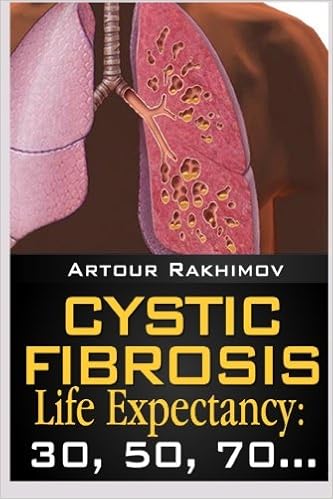 Cystic Fibrosis Life Expectancy: 30, 50, 70…, by Artour Rakhimov Cystic Fibrosis Life Expectancy: 30, 50, 70…, by Artour Rakhimov