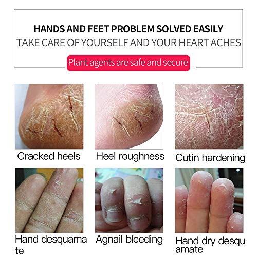 Sunshinehomely Women Hand and Foot Skin Repair, Snail Repair Cream Remove Exfoliating Feet Skin Peeling Calluses Beauty Foot Care