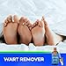Wart Remover Liquid Rapidly Removes All Kinds of Plantar and Common Warts, Papillomas, Skin Tags With no Harm and Irritation | Advanced Natural Formula | Effective Painless Wart Removal Treatmentthumb 4