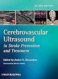 Cerebrovascular Ultrasound in Stroke Prevention and Treatment by