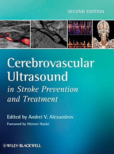 Cerebrovascular Ultrasound in Stroke Prevention and Treatment by 