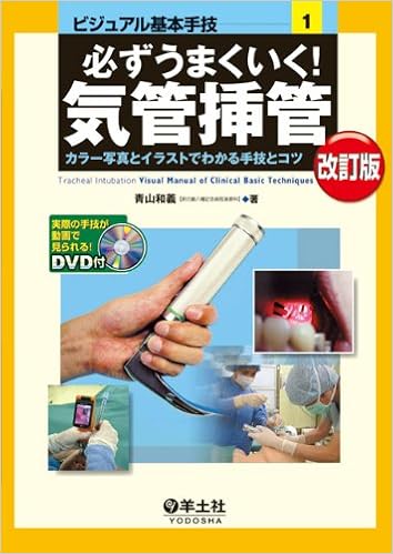 必ずうまくいく 気管挿管 カラー写真とイラストでわかる手技とコツ ビジュアル基本手技 1 青山 和義 本 通販 Amazon 必ずうまくいく 気管挿管 カラー写真とイラストでわかる手技とコツ ビジュアル基本手技 1 青山 和義 本 通販 Amazon