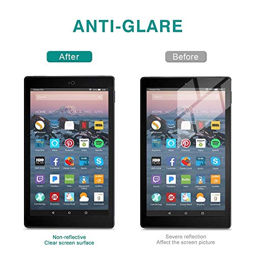 ZOEGAA Anti-Blue Light Screen Protector for Amazon Fire HD 10 Tablet 10.1\