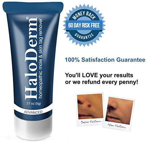 HaloDerm Advanced Mole and Skin Tag Remover Removes 5